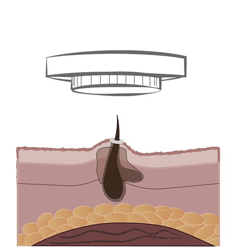 LED light gently penetrates beneath the skin’s surface,
helping support the skin’s natural renewal process and
stimulating healthy cellular activity.