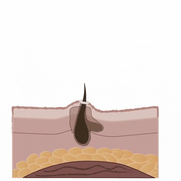 Targeted wavelengths help soothe irritation and reduce
the appearance of redness and breakouts, leaving skin
feeling calmer and more balanced.